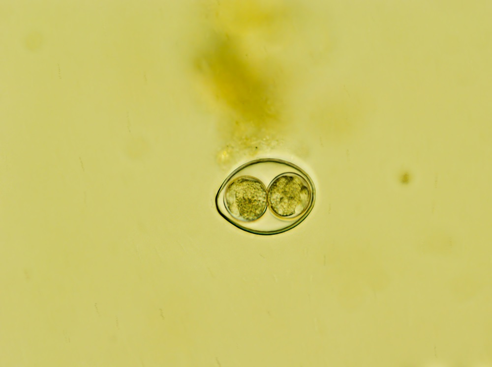 Aspecto microscópico del parásito Cystoisospora coccidia que aparece como un círculo grande con dos círculos más pequeños en el centro sobre un fondo amarillo verdoso.