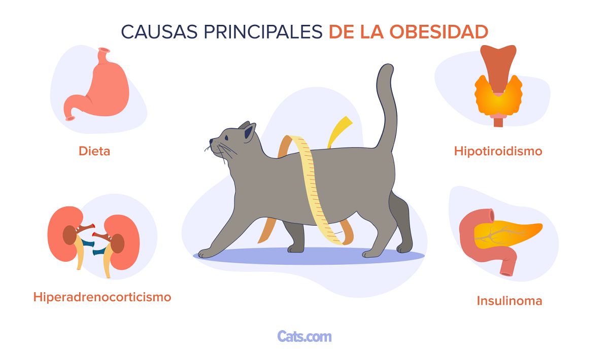 Principales causas de la obesidad